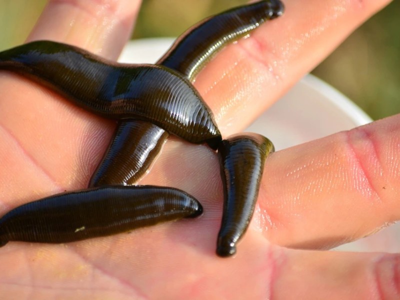 An ancient therapy for circulatory complaints celebrating a revival – Blood-letting with&nbsp;leeches